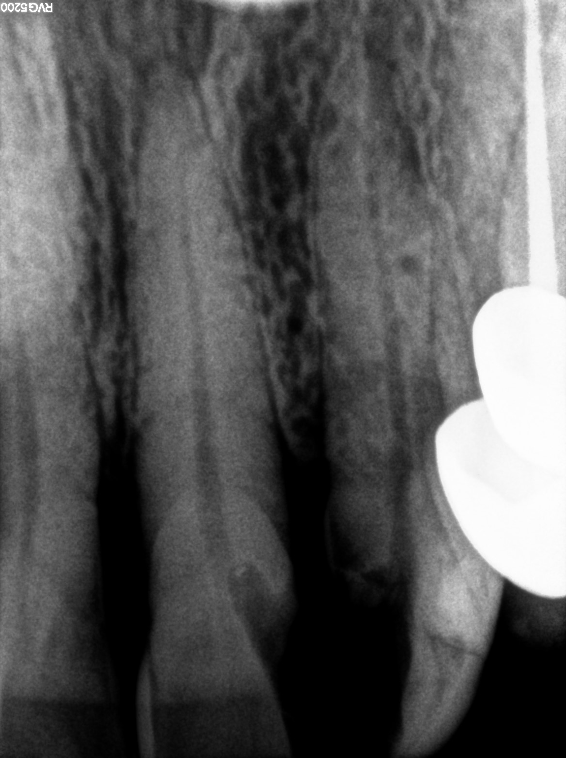 Dental X-ray